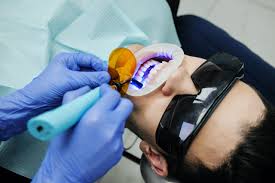 All About Root Canal Treatment — Myths & Facts