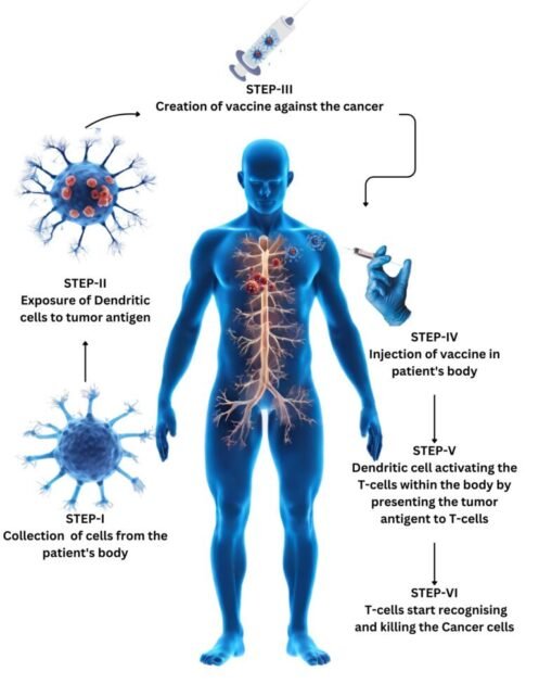 Dendritic cell therapy